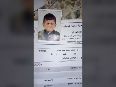 نداء إنساني عاجل.. مأساة أسرة يلتهم السرطان أطفالها ووالدهم عاجز عن توفير مسكّن للألم