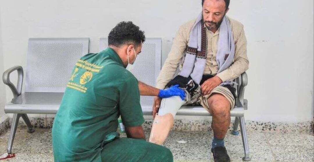 مركز الأطراف الصناعية بتعز يقدم ٢٢٥٤ خدمة تأهيلية مجانية لـ٦٦٤ مستفيدًا خلال سبتمبر الماضي